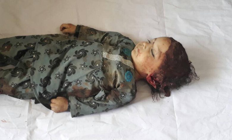 Child afghani victim