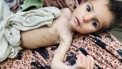 Afghanistan starving child