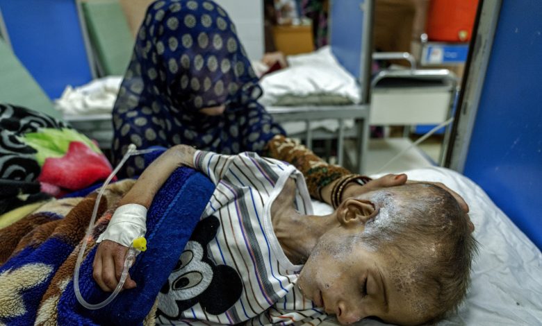 Afghanchildpoor